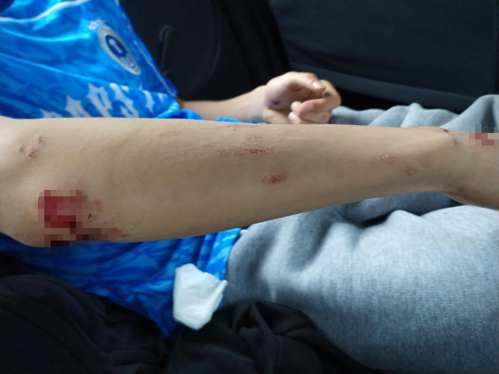ZONGULDAK’IN KOZLU İLÇESİNDE MEYDANA GELEN OLAYDA OKUL ÇIKIŞI SAHİPSİZ KÖPEKLERİN