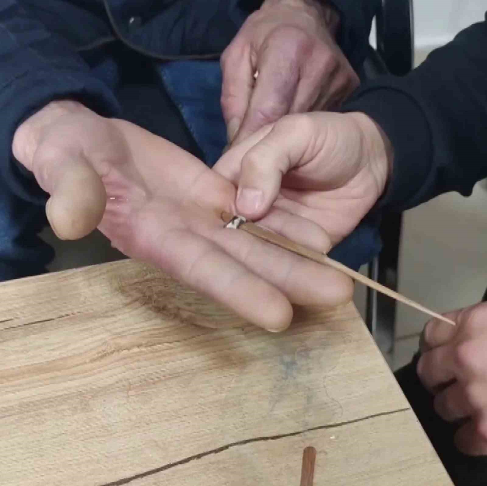 SİVAS’TA YAŞLI ADAMIN PARMAĞINA SIKIŞAN YÜZÜĞÜ İTFAİYE ÇIKARDI.
