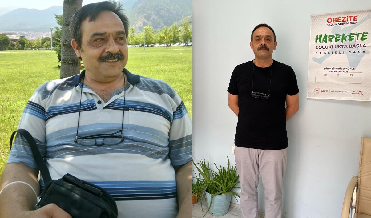 KİLOLARI NEDENİYLE SAĞLIK PROBLEMİ YAŞAMAYA BAŞLAYAN VE BUNDAN KURTULMAK İÇİN