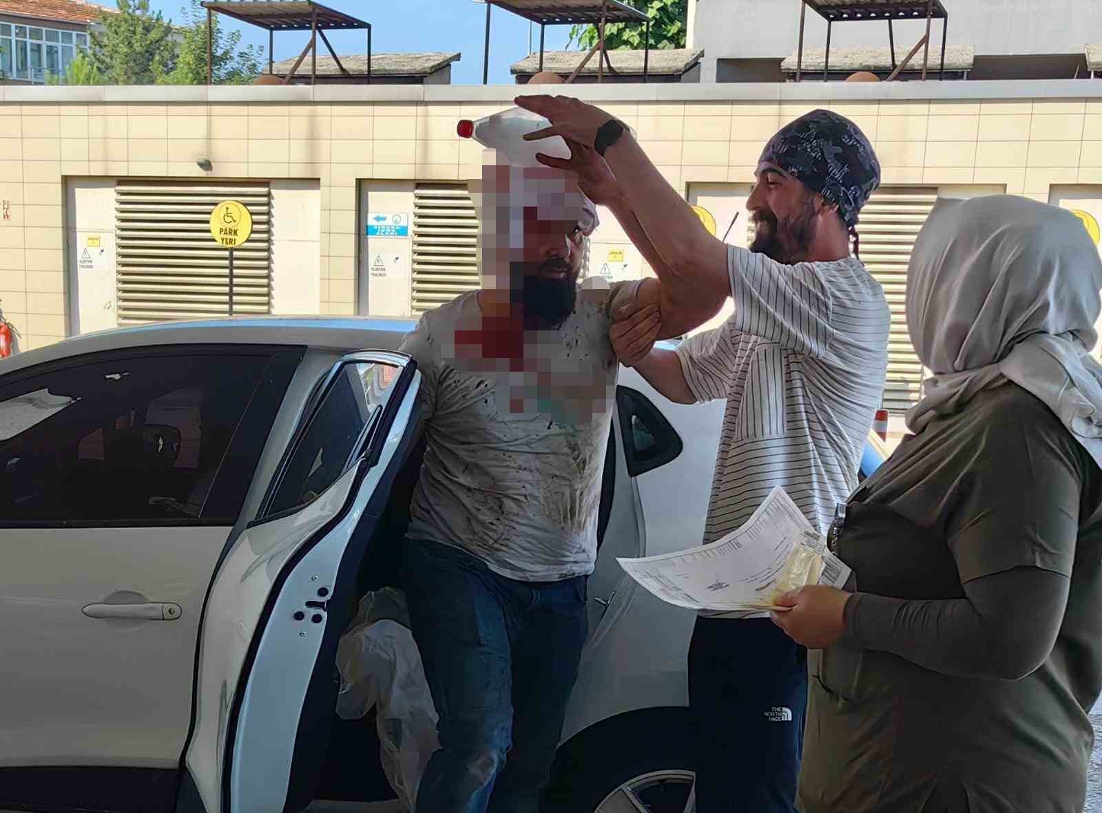 BURSA'DA KURBAN KESERKEN YARALANAN ACEMİ KASAP SAYISI 462 OLDU.
