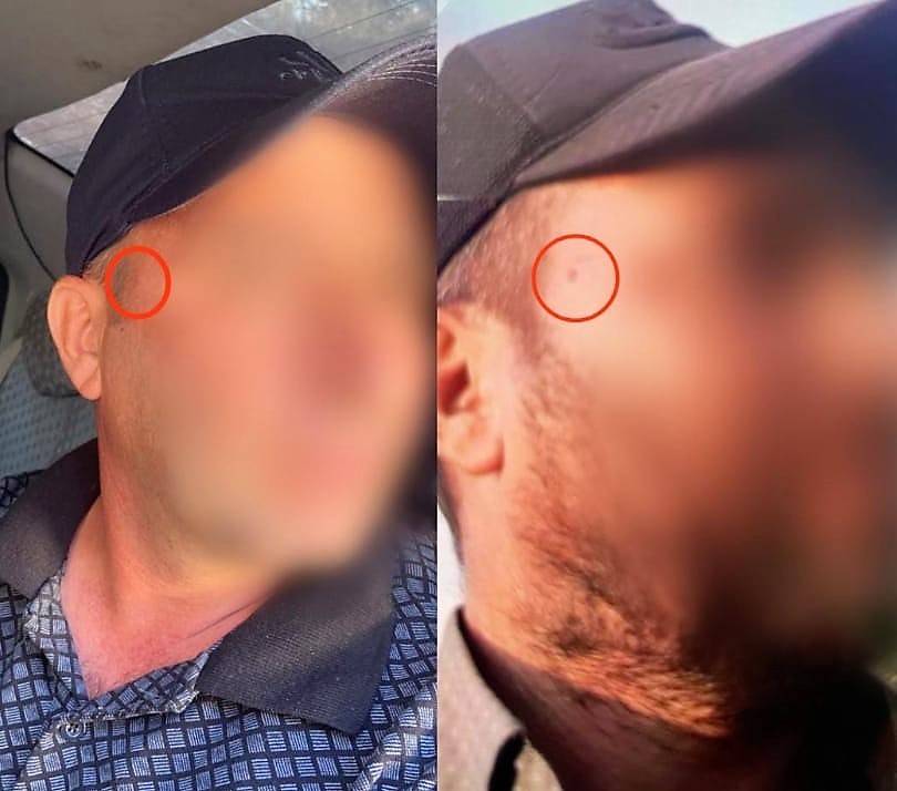 ŞEBEKE ÜYELERİNDEN BİRİSİNİN, JANDARMAYA YAKALANMAMAK İÇİN YÜZÜNDEKİ BENİ ALDIRDIĞI ORTAYA
