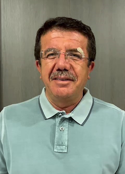 MUĞLA’DA GEÇİRDİĞİ KAZADA HAFİF YARALANAN EKONOMİ ESKİ BAKANI NİHAT ZEYBEKCİ,