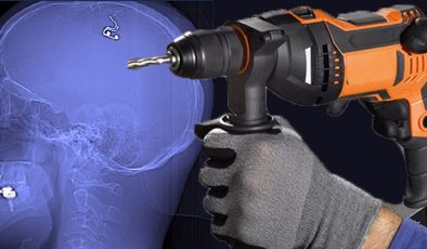 Rüyalarını kontrol edebilmek için kafasını matkapla deldi