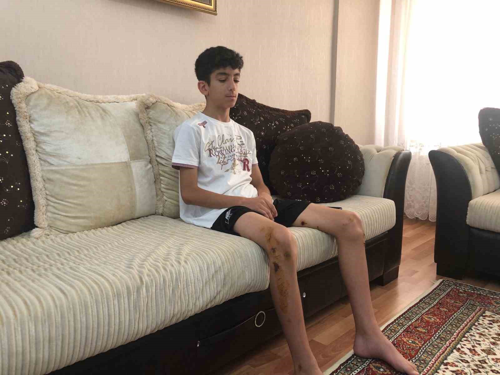 YENİMAHALLE İLÇESİ TURGUT ÖZAL MAHALLESİ’NDE MEYDANA GELEN OLAYDA, 13 YAŞINDAKİ