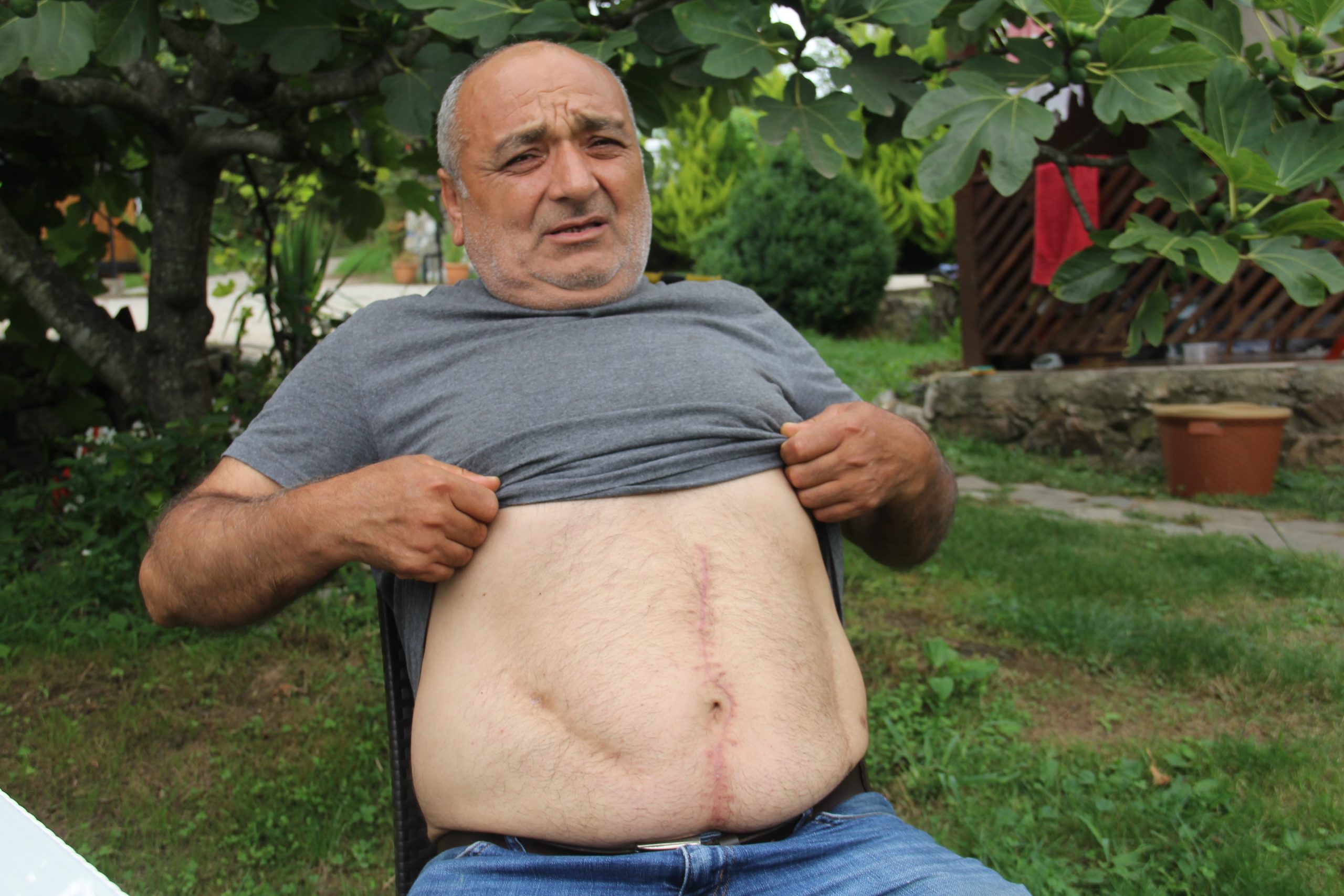 GİRESUN’DA  ANJİYO  İÇİN GİTTİĞİ HASTANEDE KARNINDA ÜÇ PARÇA