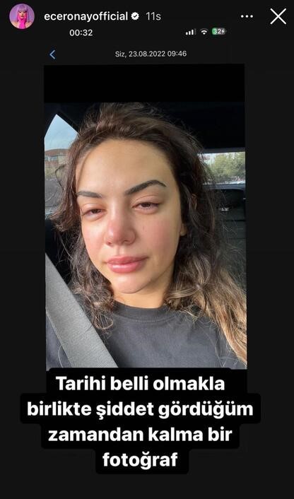 Boşandığı eşinden tehditler aldığını ve şiddet gördüğünü belirten şarkıcı Ece