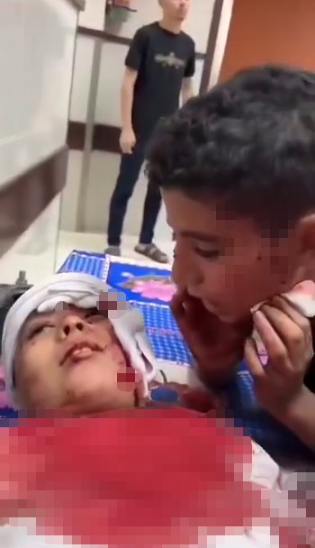 Gazze’de Filistinli bir çocuk, İsrail’in hastaneye düzenlediği saldırıda yaralanan kardeşine