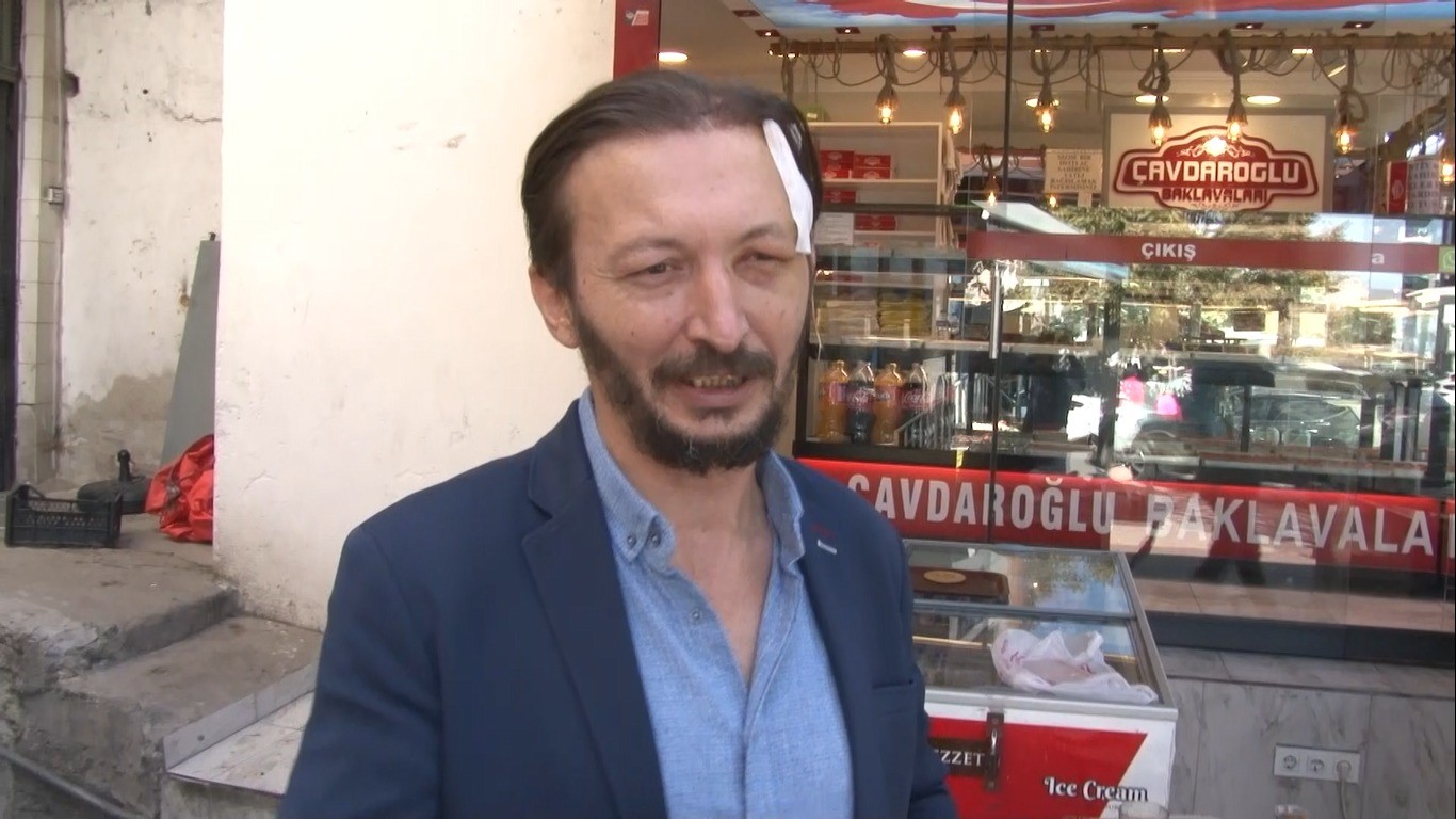 ESENLER'DE İŞ YERİNİN ÖNÜNDE KAVGA EDENLERE BAKMAK İÇİN ÇIKAN DIŞARI