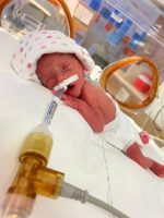 Gebeliğin 26. haftasında 500 gram ağırlığında dünyaya gelen Nisan bebek,