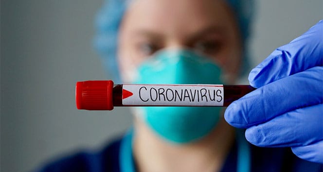 Koronavirüste (Covid-19) pozitiflik oranları
