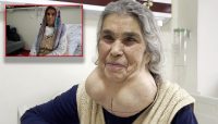 Boynun ön alt kısmında büyük bir şişliğin oluşmasına rağmen doktorlardan