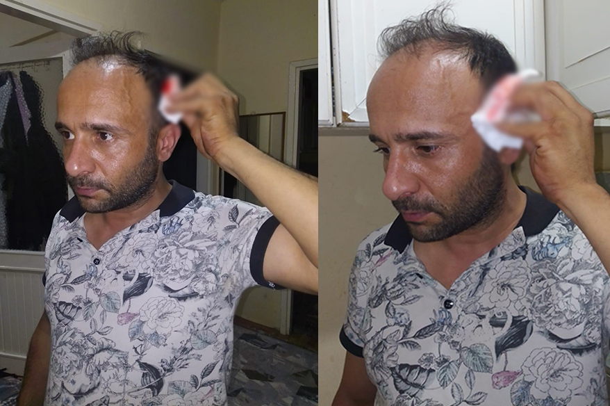 Kartal’da aynı evde yıllardır kirada olan bir vatandaş, ev sahibinin