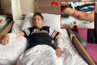 Rize’nin Güneysu ilçesinde 12 yaşındaki çocuk sevdiği köpek tarafından saldırıya