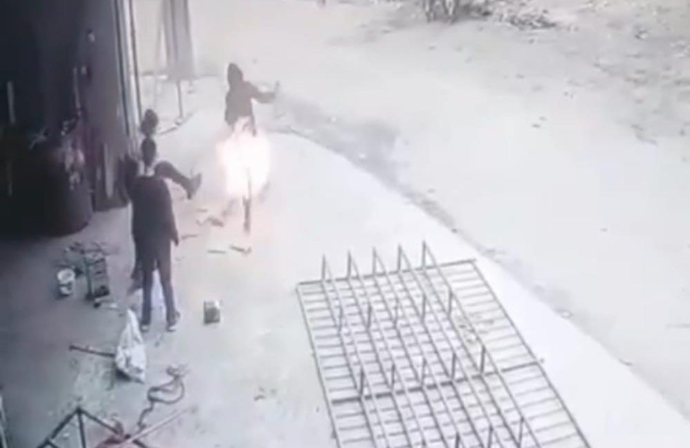Adana’da bir çocuğun yanan tenekeye tekme atması sonucu arkadaşı yandı.