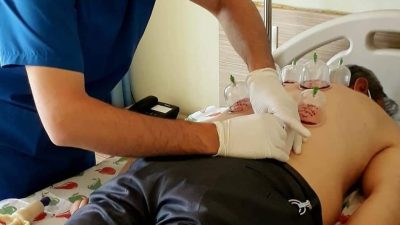 Son yıllarda mezoterapi, ozon ve halk arasında hacamat olarak bilinen