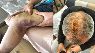 Sosyal medya hesabı üzerinden Erdek Belediyesi ile ilgili eleştiride bulunan