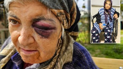 Antalya’da zihinsel engelli Lütfiye Yıldırım, diyalize girmek için gittiği merkezde