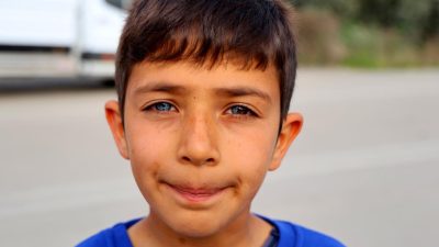 &nbsp;Adana’da doğuştan bir gözü mavi, diğer gözünün de yarısı mavi