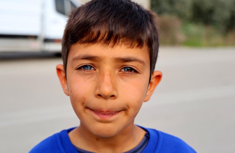 &nbsp;Adana’da doğuştan bir gözü mavi, diğer gözünün de yarısı mavi