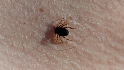 Doğu Karadeniz Bölgesinde havaların ısınmasıyla birlikte Gümüşhane’de kene vakaları görülmeye