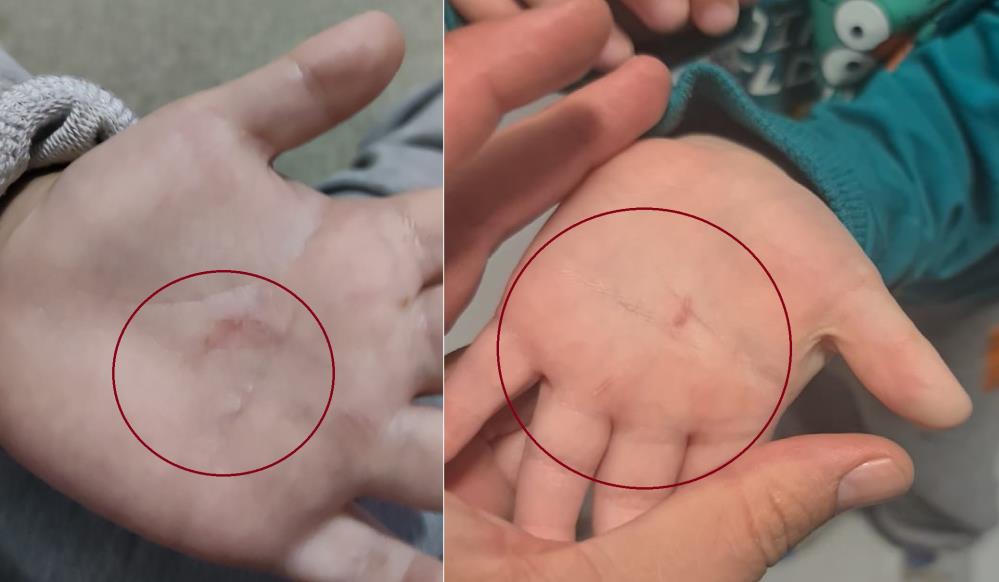 Bandırma Belediyesi’nin Türkan Saylan Gündüz Bakım Evi’nde, öğretmenin, 4 yaşındaki