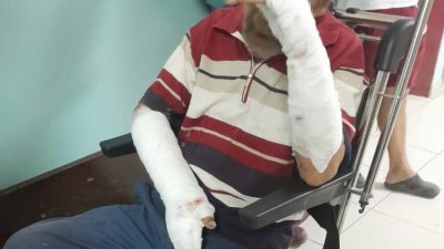 Manyas’ta yaşayan bir kişi, köpeklerin saldırısına uğrayarak ciddi şekilde yaralandı.Manyas’a