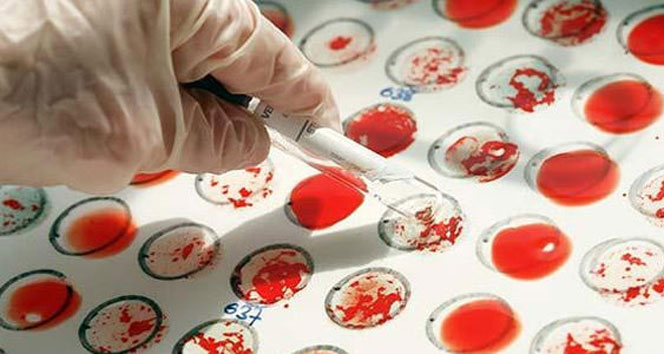 Türkiye’de erkeklerde görülen kanserlerin yüzde 7,4’ünü, kadınlarda ise yüzde 6’lık