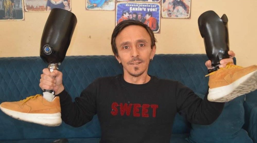 Minik Dev Adam’ın örnek hikâyesi Ayvalık’ta; halk dilinde “cüce” olarak da nitelendirilen akondroplazı hastası ve