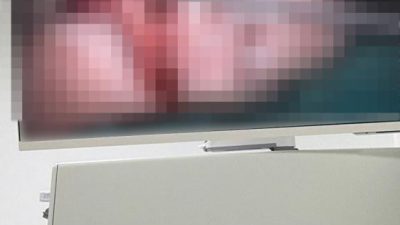 Bandırma ilçesinde yaşanan asansör kazasında parmağı kopan bir vatandaş, mikrocerrahi