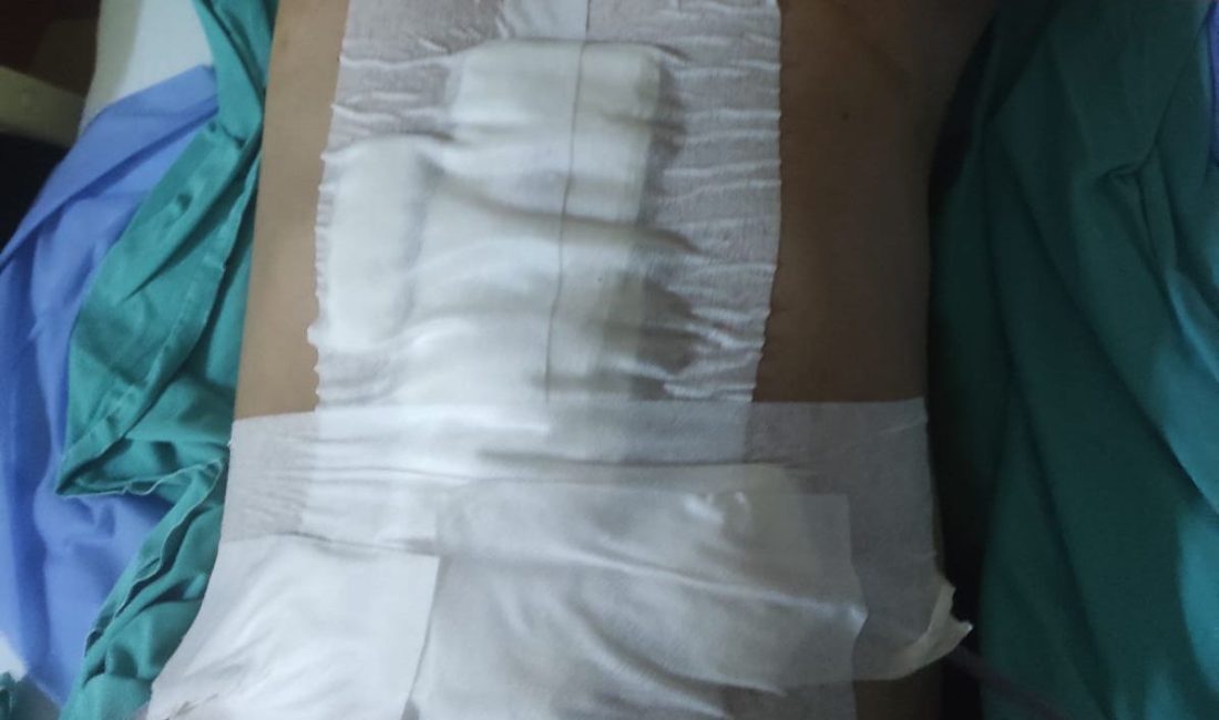 Bandırma Sahilinde Havalı Tüfek Kazası Genci Canından Ediyordu Bandırma sahilinde havalı tüfekle balon atış alanında meydana gelen kazada